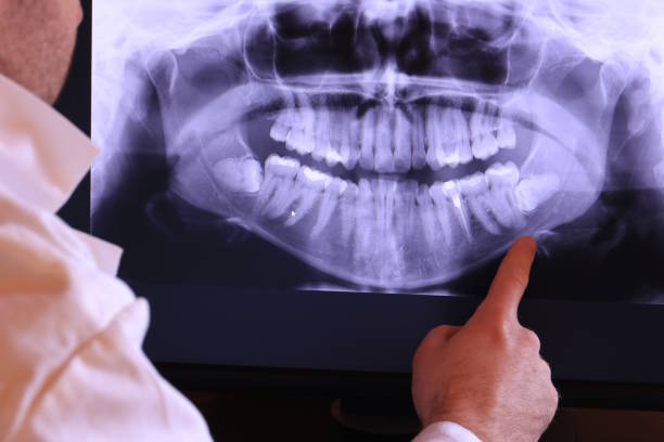 Best Walk-In Emergency Dentist in Cvallis, OR