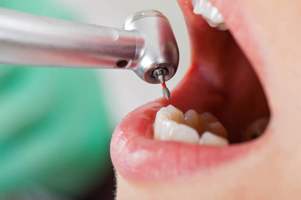 Best Emergency Broken Tooth Repair in Cvallis, OR